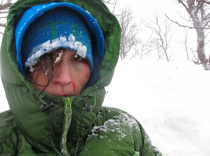 dame med blod og snø i ansiktet
